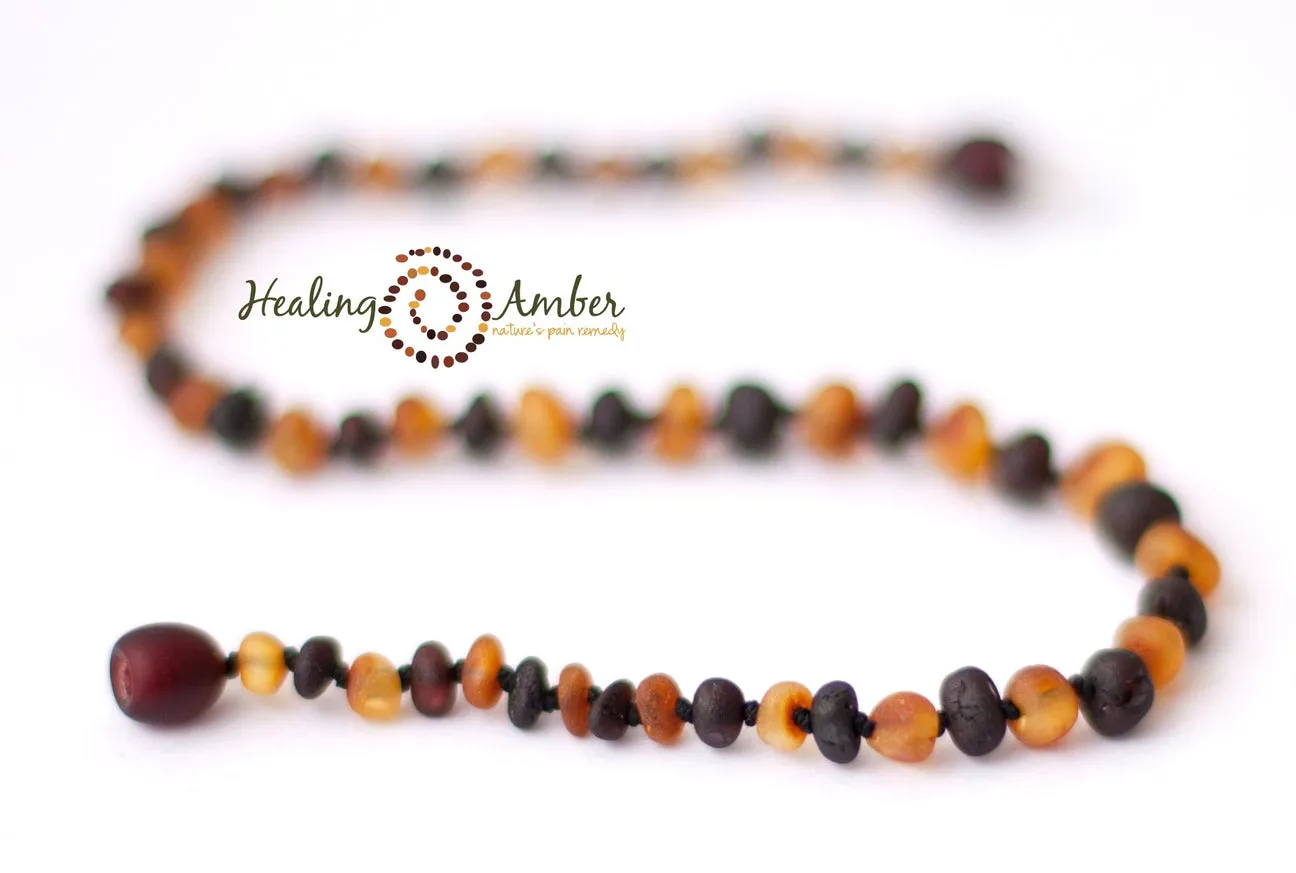 Healing Amber Raw Necklace - 11"