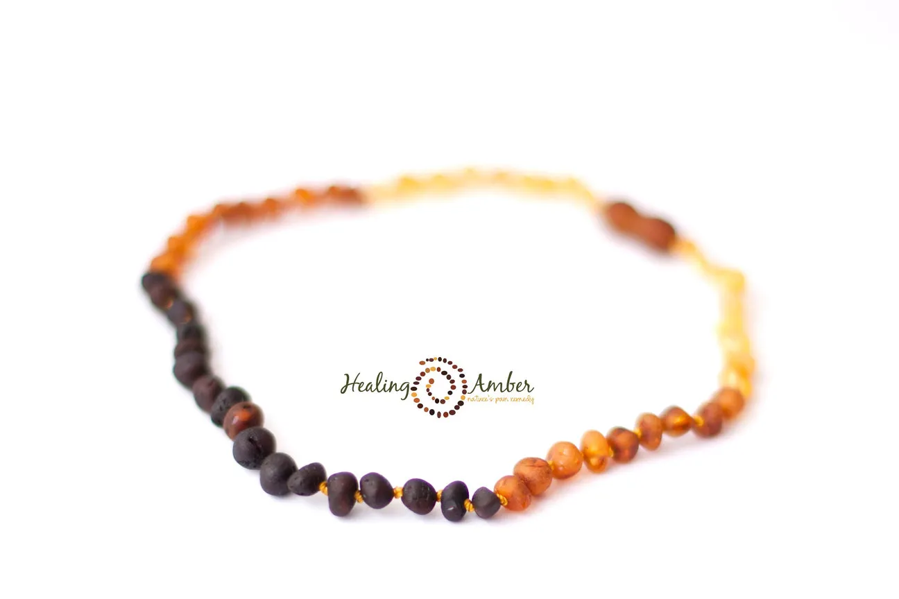 Healing Amber Raw Necklace - 11"