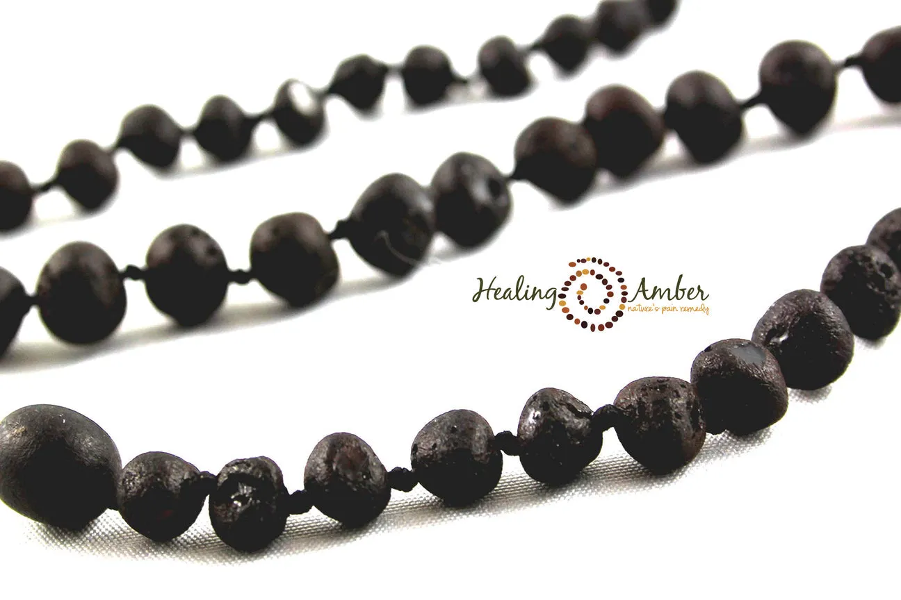 Healing Amber Raw Necklace - 11"