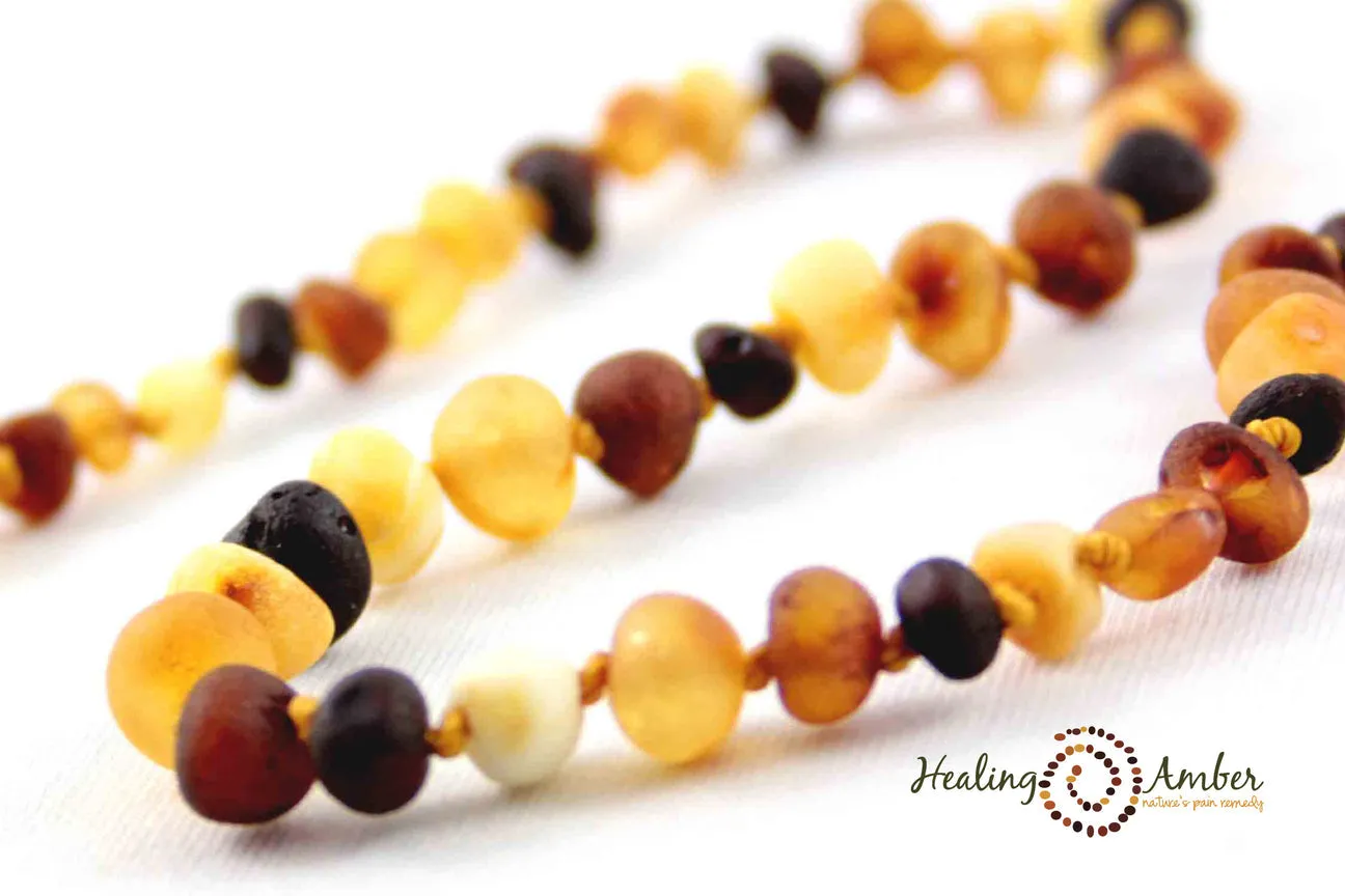 Healing Amber Raw Necklace - 11"