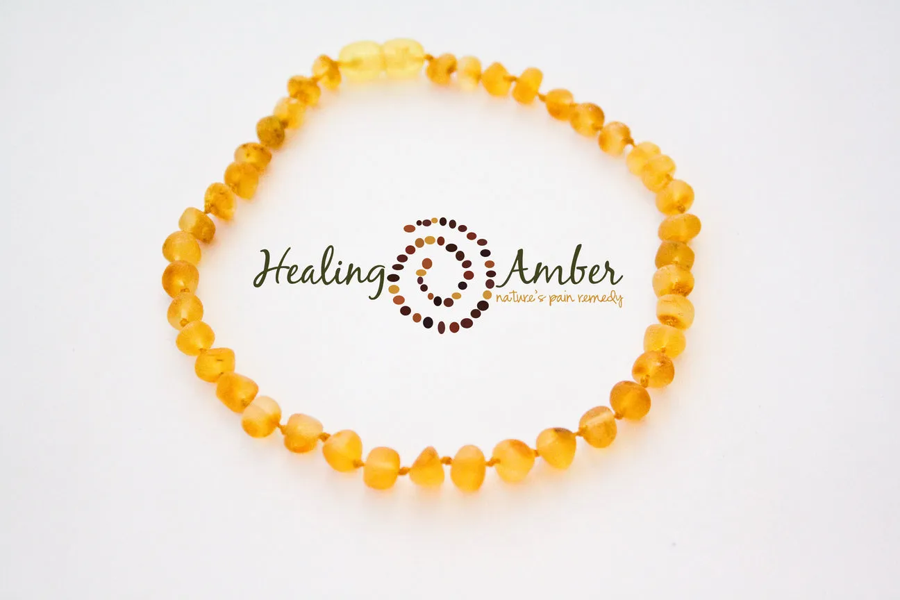 Healing Amber Raw Necklace - 11"
