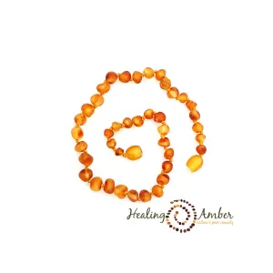 Healing Amber Raw Necklace - 11"